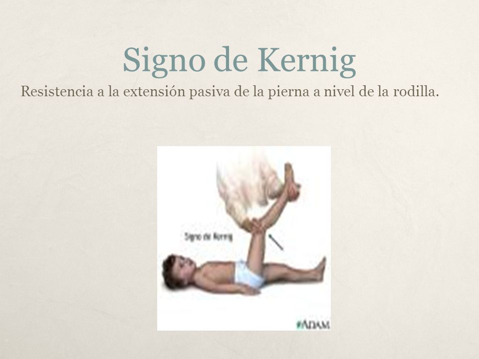 SIGNO DE KERNIG EPUB SIGNO DE KERNIG EPUB